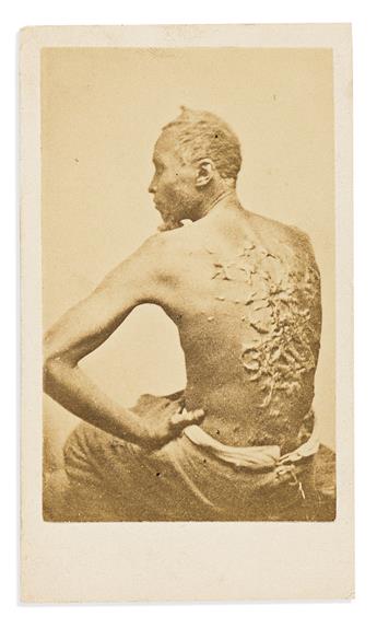 (SLAVERY.) [McPherson & Oliver; photographers.] [The Scourged Back.]